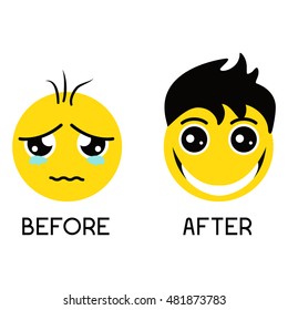 Sad balding emoticon before alopecia treatment and happy smiley with gorgeous hair after procedure. Vector set of Emoji isolated on a white background. Health care concept.