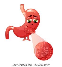 Sad cartoon stomach character with gastritis, inflammation in epithelial cells under magnification. Vector illustration on white background
