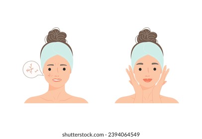 Sad cartoon woman with dry skin problem compare with Happy  woman with normal skin. Skin care procedure concept person. Vector design illustrations.
