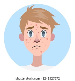 Sad man with acne on the face. Pimple on the face. Dermatology problem and puberty. Trouble with skin. Isolated flat vector illustration