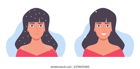 Sad woman with flake on head and shoulders and joyful woman without dandruff. Dry scalp problem. Disease of skin, health and scratching hair. Cartoon flat style isolated vector concept