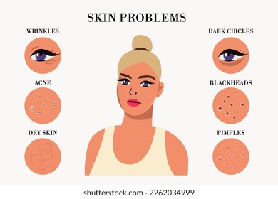 sad woman and set of most common female facial skin problems needs to care about: acne, pimples, wrinkles, dry skin, blackheads, dark circles under eyes. vector infographi .