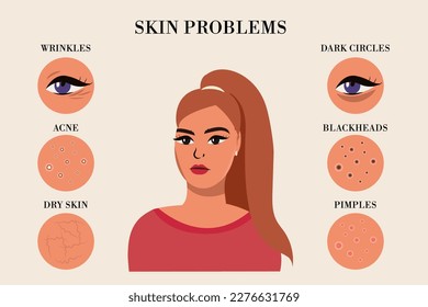 sad woman and set of most common female facial skin problems needs to care about: acne, pimples, wrinkles, dry skin, blackheads, dark circles under eyes. vector infographi .