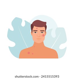 Triste hombre preocupado con problema de acné y granos rojos en ilustración de vector facial