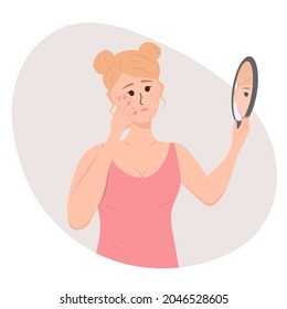 Sad young woman is looking at her pimples in the mirror. Person with acne problem. Beauty, skin care lifestyle concept. Skin conditions and dermatology.