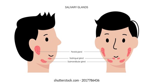 Salivary Gland In Human Mouth. Parotid, Submandibular, And Sublingual Glands. Produce Of Saliva Through A System Of Ducts. Xerostomia Oral Disease Anatomical Poster. Medical Flat Vector Illustration.