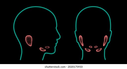 Salivary Gland In Human Mouth. Parotid, Submandibular, And Sublingual Glands. Produce Of Saliva Through A System Of Ducts. Xerostomia Oral Disease Anatomical Poster. Medical 3d Vector Illustration.