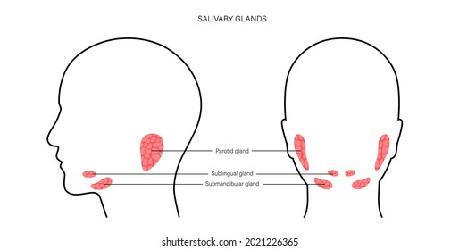 Salivary Gland In Human Mouth. Parotid, Submandibular, And Sublingual Glands. Produce Of Saliva Through A System Of Ducts. Xerostomia Oral Disease Anatomical Poster. Medical Flat Vector Illustration.