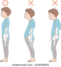 Sample of good and bad posture in men_pelvis