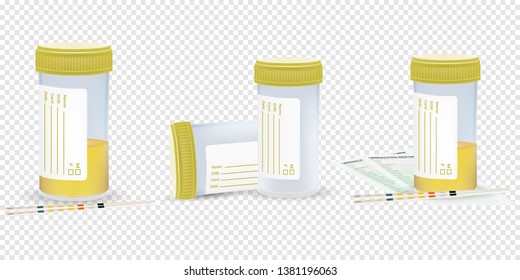 A Sample Of Urine. Laboratory Analysis Of Urine Using Test Strips. Vector Illustration Set, Eps 10.