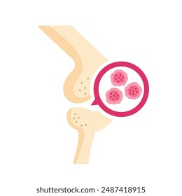 sarcoma bone cancer disease isolated