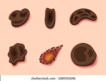 scab skin , wound , bleeding vector
