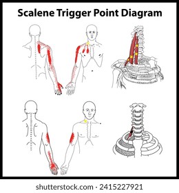 Scalene Trigger Point vector Diagram