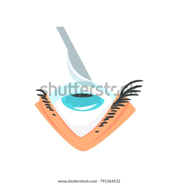 Scalpel Over Human Eye Eye Surgery Stock Vector (Royalty Free