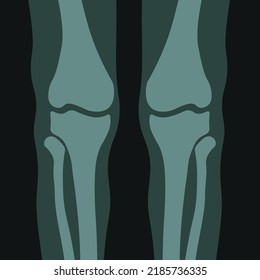 Scan of human knees bones and joints, examination and diagnosis with help of x ray. Healthcare and rheumatism analysis, physical care in hospital or clinics. Vector in flat style illustration