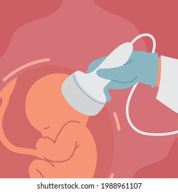scanning baby on womb gynecology diagnosis