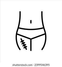 Scar Removal icon. injury or female birthmark on belly removal symbol. scar on body due to surgery treatment while pregnancy stitch vector. cesarean abdominal operation skin scar recovery line logo