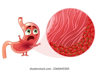 Abgerüstete Cartoon-Magenfigur mit einer Helicobacter pylori-Infektion in Epithelzellen unter Vergrößerung. Vektorgrafik auf weißem Hintergrund
