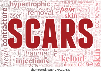 Scars word cloud isolated on a white background.