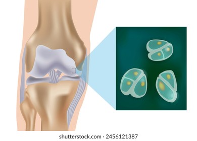 Representación esquemática del cartílago articular y los condrocitos de la superficie articular. Cambios estructurales y moleculares durante el proceso de AO. Condrocitos