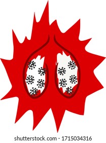 a schematic image of a lung with a viral infection in red symbolizes danger and inflammation