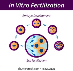 Scheme Artificial Insemination Vitro Fertilization Chart Stock Vector ...