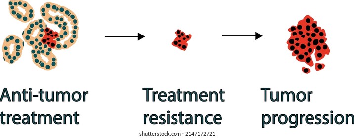 scheme of development of the tumor resistance to therapy, tumor cells, vector graphics, illustration