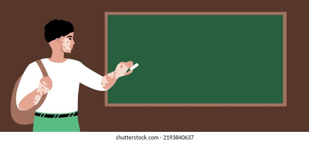 Schuljunge mit Vitiliga an der Tafel, flache Vektorgrafik oder Kopienraum-Vorlage für Design und Overlay