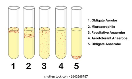 The Science microbiology experiment: oxygen requirement for microbial, bacteria - The vector show characteristic of each bacteria when cultivated in medium 