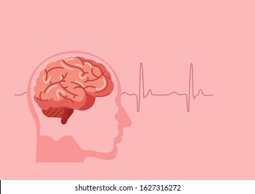 Scientific Medical Illustration Of Human Brain Stroke Illustration. Types Of Human Brain Stroke Illustration. Vector, Esp