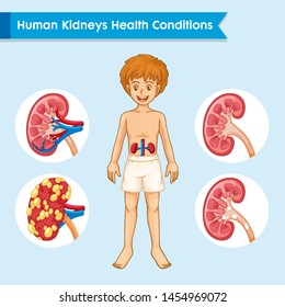 Scientific Medical Illustration Of Kidney Disease Illustration