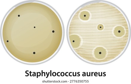Scientific vector illustration of Staphylococcus aureus bacterial colonies and inhibition zones in laboratory petri dishes