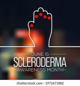 Scleroderma awareness month is observed every year in June, it is an uncommon condition that results in hard, thickened areas of skin and sometimes problems with internal organs and blood vessels.