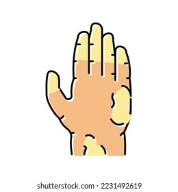 scleroderma skin disease color icon vector. scleroderma skin disease sign. isolated symbol illustration