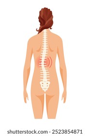 Scoliosis affecting individuals of all ages. Schematic poster of a woman with scoliosis