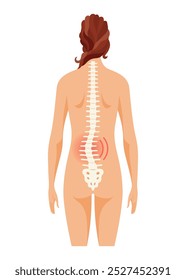 Scoliosis affecting individuals of all ages. Schematic poster of a woman with scoliosis