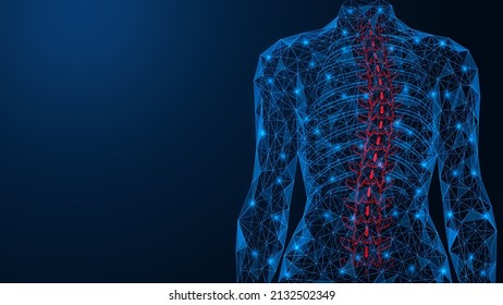 Scoliosis, curvature of the spine. Incorrect deformation of the human back. Polygonal design of interconnected lines and points. Blue background.