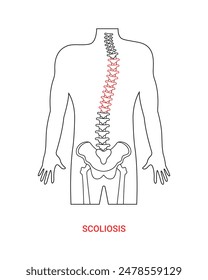 Scoliosis disease medical design with line style