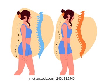 Scoliosis in girl concept. Woman with problems with pisture. Health care and medicine, treatment. Correction of posture. Cartoon flat vector illustration isolated on white background