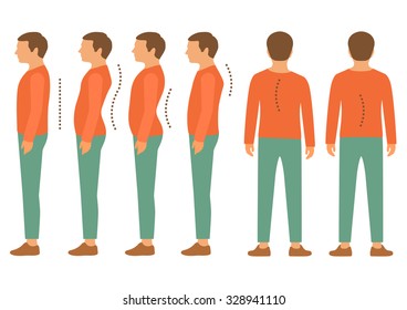 Scoliosis, Lordosis Spine Disease, Back Body Posture Defect