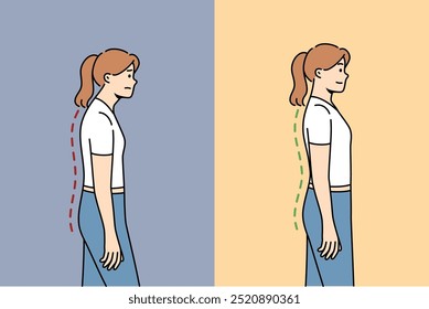 Escoliosis u osteocondrosis en la mujer, debido a problemas con la postura y dolor en la columna vertebral, que se ha recuperado después de hacer ejercicio. Problema de escoliosis en empleada de oficina debido al estilo de vida sedentario