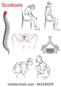 Scoliosis, a slouch, bad posture.