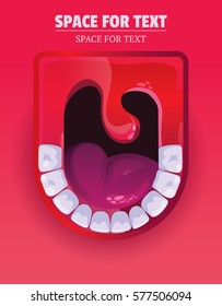 Screaming Mouth On A Bright Red Background. Poster With Teeth,Tongue And Throat.Healthy Clean Teeth.Vector Illustration.ENT.Dentist.Smile Happy Logo.Scream.Blank For The Poster.Rock