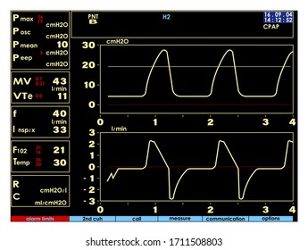 Screen, monitor with signs of the artificial lung ventilation device in a realistic design. Isolated vector