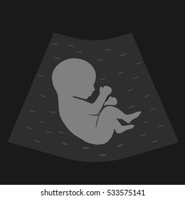 Screening baby in womb drawn in flat style