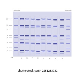 The SDS-PAGE (sodium dodecyl sulfate-polyacrylamide gel electrophoresis) result of target protein detection that molecule separating with molecular mass