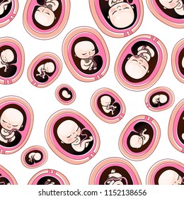 Seamless baby pattern, babies and newborns. Human fetus inside the womb 1 to 9 months.Vector illustrations