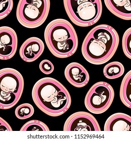 Seamless baby pattern, babies and newborns. Human fetus inside the womb 1 to 9 months.Vector illustrations