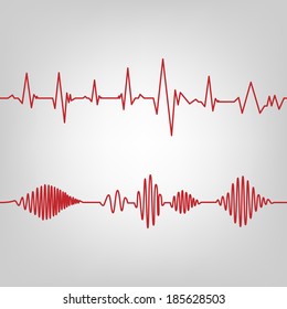 seamless ECG graph