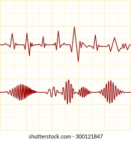 Seamless ECG Graph